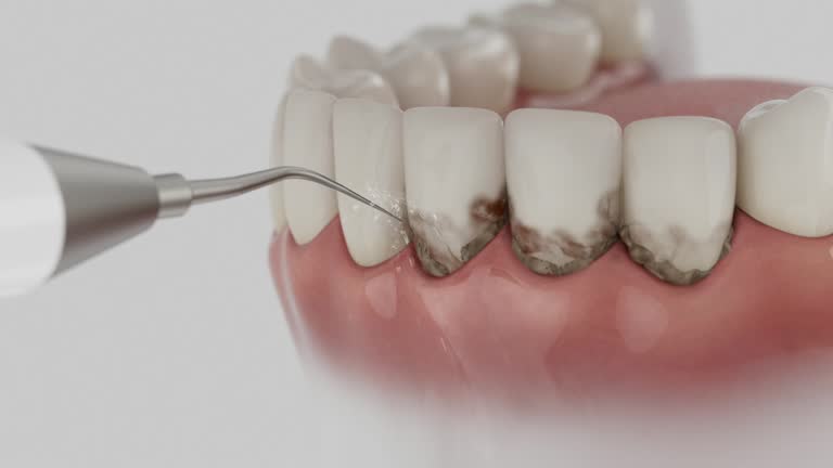 Trusted Invisalign Clear Aligners service in Lakeview, GA - Dentist Open Now